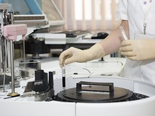 Badania laboratoryjne – na czym polega toksykologia? Kiedy i w jakim celu wykonuje się to badanie?